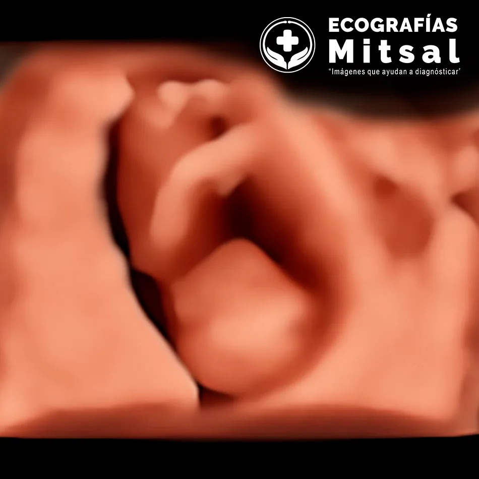 Ecografía genética
