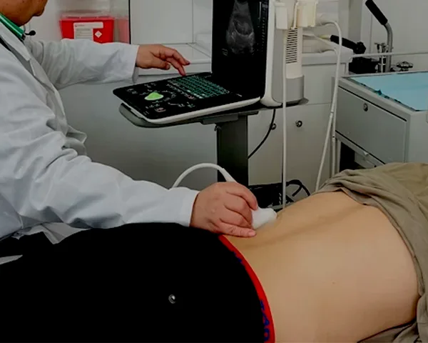 Ecografía renal